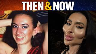 40+ Celebrities Before and After Plastic Surgery