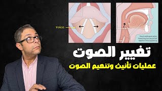 تنعيم الصوت الخشن للنساء | عمليات تأنيث وترفيع الصوت