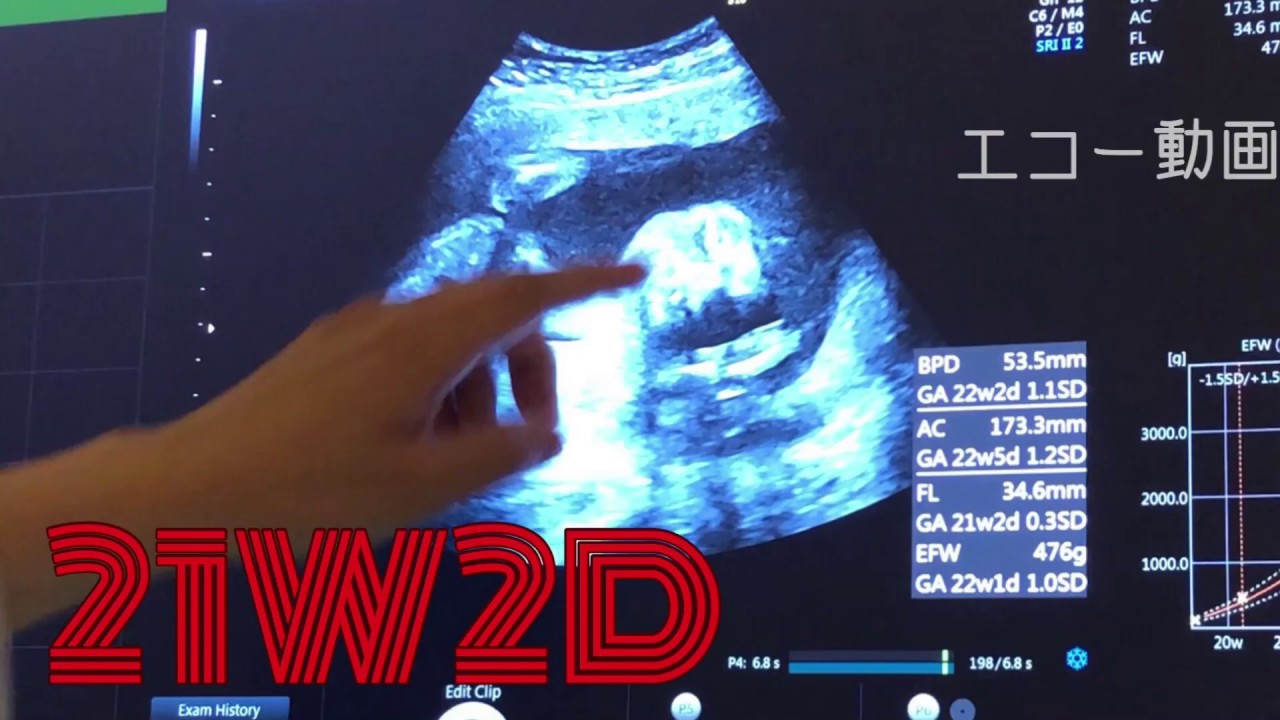 21週2日 21w2d 妊娠6ヶ月 赤ちゃん 超音波エコー動画 Youtube