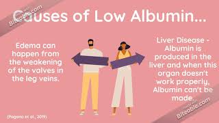 Why Do Low Albumin Levels Cause Edema in my Feet?