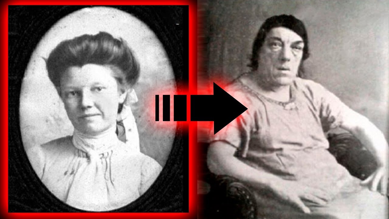 La Donna Che Diventò Un Fenomeno Da Baraccone Per Sfamare I Figli