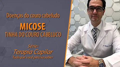 Tinha do couro cabeludo causas?