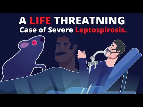 लेप्टोस्पायरोसिस म्हणजे काय? गंभीर संसर्गाची वास्तविक घटना (वेइल रोग)