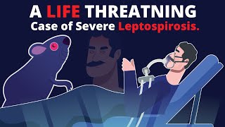 What is Leptospirosis? How does it cause Organ Failure? & How to treat?