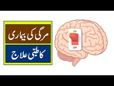 Mirgi Ki Bemari Ka Tibbi Elaj - Epilepsy Treatment in Urdu