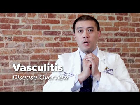 Vasculitis Disease Introduction | What is Vasculitis? | Johns Hopkins Rheumatology