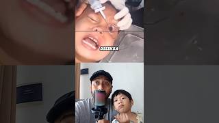 Pertolongan pertama trauma pada MATA ⁉️😰 #faktakesehatan #edukasi #drbimo #faktaunik