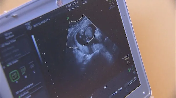 South Carolina abortion ban bill stalls in Senate subcommittee