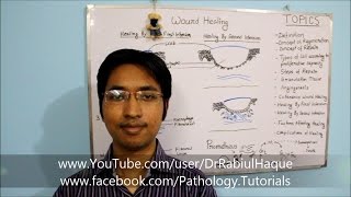 Wound Healing: Part 1 - Concept of Regeneration, Repair, Granulation Tissue & Angiogenesis (HD)