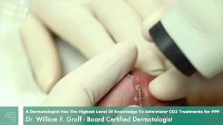 Dr. Groff Demonstates The Co2 Laser To Remove Pearly Penile Papules Adult Content