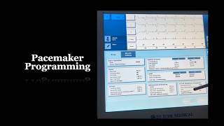 Merlin PCS Demo - Pacemaker Programming | Part 3 screenshot 5