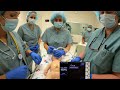 Cord management initial steps  ventilation neonatal resuscitation education 1 2023