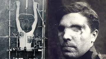 Edgewood Arsenal: CIA’s Experiments To Break A Man