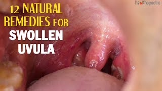 12 Natural Remedies For Swollen Uvula | Healthspectra