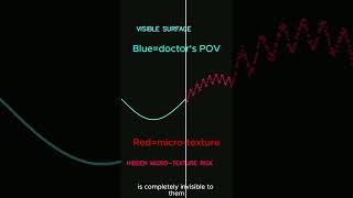 How CNNs help orthopedic surgeons! #medicine #physics #stem #biophysics