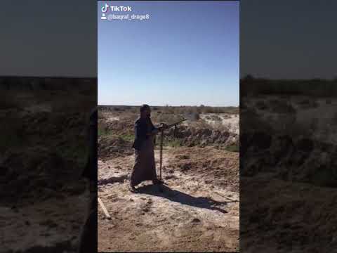 فحص بيكيسي ام حديبه