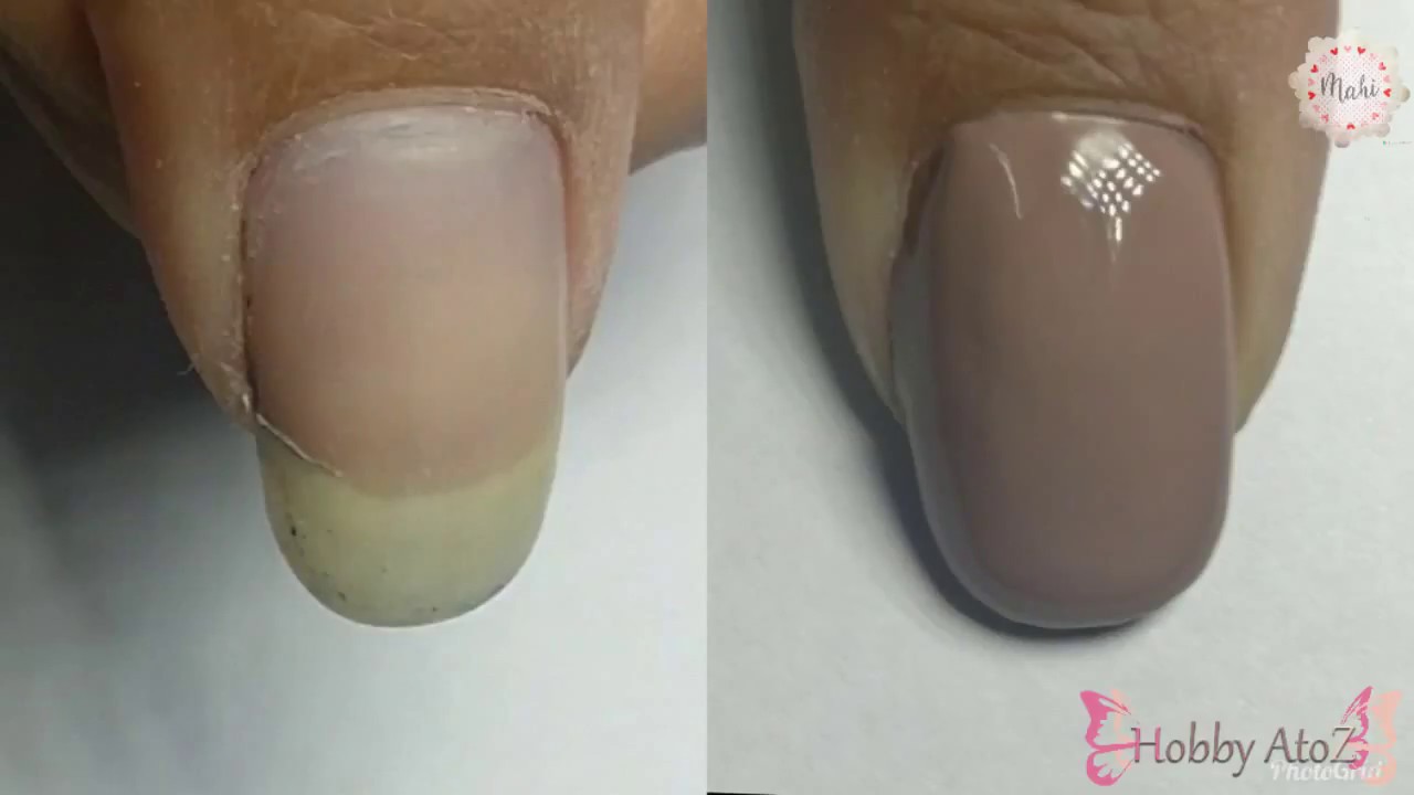 How to repair a broken nail at home, a easy step by step DIY tutorial l