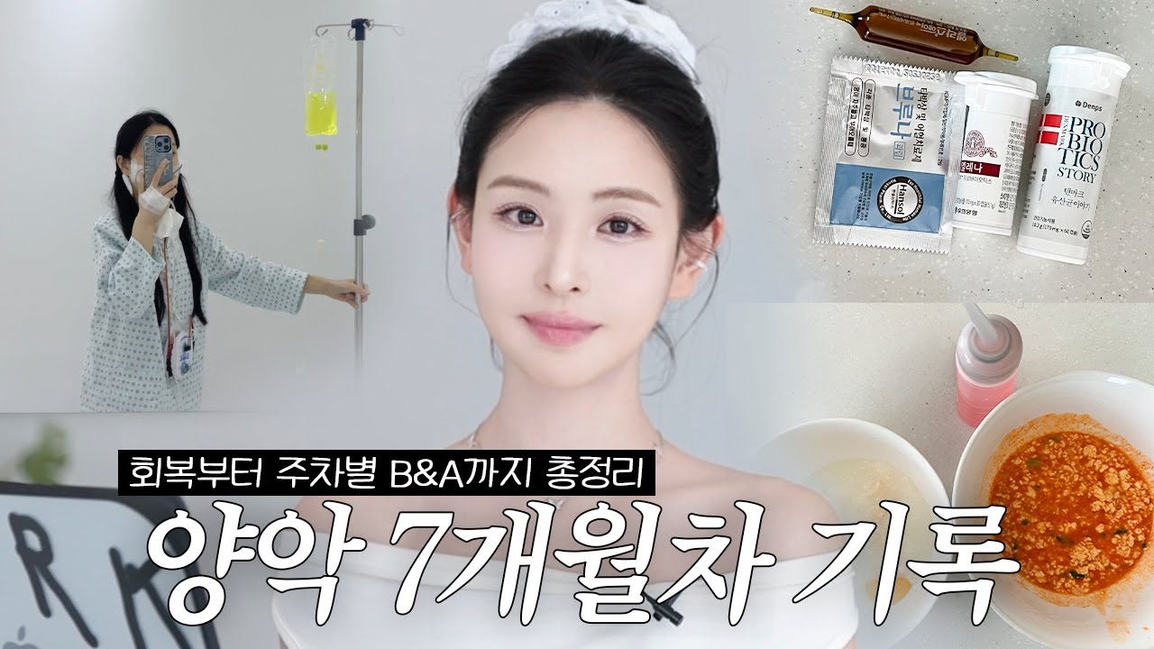 양악 수술 7개월차 리얼 후기｜주차별 B&A 정리 + 추천 식단·붓기 꿀팁 총정리