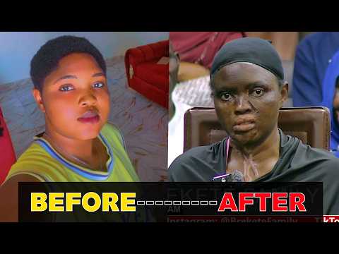 ACID ATTACK SURVIVOR RETURNS HEALING – ORDINARY PRESIDENT PLEDGES MORE SUPPORT
