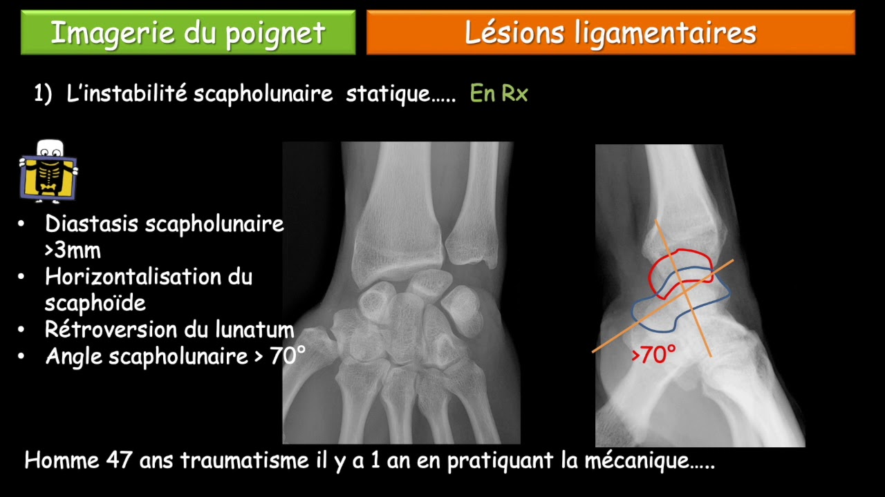 Imagerie du poignet en 20'