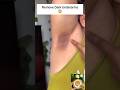 Get Rid Of Dark Underarms.Underarms Cleaning Tips.#darkunderarms #cleaning #foryou #youtubeshorts