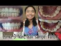 DIY Cara Cepat Memutihkan Gigi & Menghilangkan Karang Gigi Tidak sampai 10k ! Mudah dan Murah!