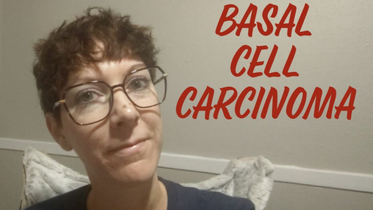 Basal Cell Carcinoma YouTube