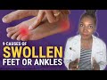 Foot and Ankle Swelling: 9 Dangerous Causes You Should NEVER Ignore!