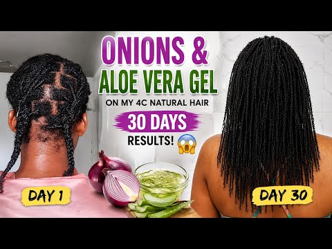 I tried onions and aloe vera gel on my 4c natural hair for 30 days and this happened 😱