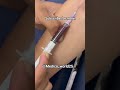 Blood sample collection for investigation #medicoworld #doctor #medicoworld #doctor #medicine