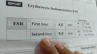 قراءة تحليل سرعة الترسيب واهم الاعراض التى يلزم عمل تحليل erythrocyte ( ESR )sedimentation rate