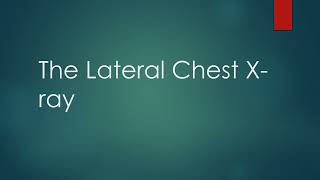 Critiquing the Lateral Chest X-ray