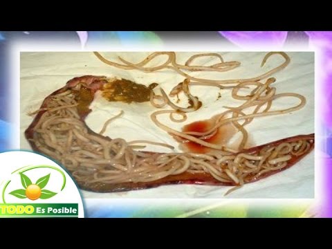 Como eliminar lombrices en ninos de forma natural