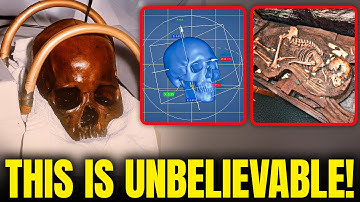 Here Is Why DNA Analysis of an 8,000-Year-Old Skull Left Scientists Shocked