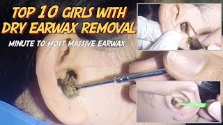 Top 10 Girl's Dry Earwax Removal