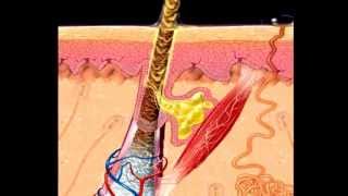 Видео Что происходит в коже. Когда на коже мир или когда воспаление с прыщами и угрями - идёт война. (автор: ShambalaTV)