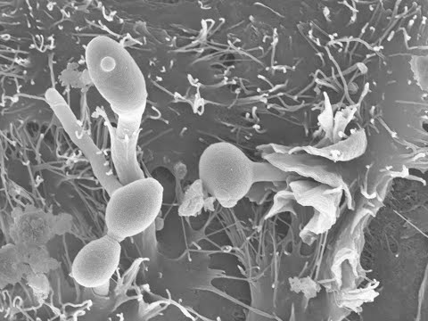 Video: Saccharomyces Kudriavzeviin 2-ketohappodekarboksylaasin Aro10p Laajan Substraattispesifisyyden Karakterisointi Ja Sen Vaikutus Aromin Kehitykseen