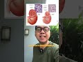 Gagal ginjal bisa sembuh? Penjelasan dari dokter spesialis ginjal