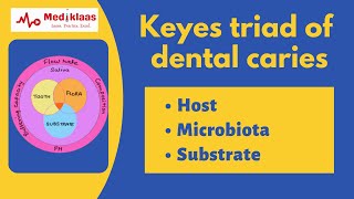Keyes Triad of Dental caries l Pediatric and Preventive Dentistry l Mediklaas by Mediklaas 2,929 views 3 years ago 5 minutes, 39 seconds