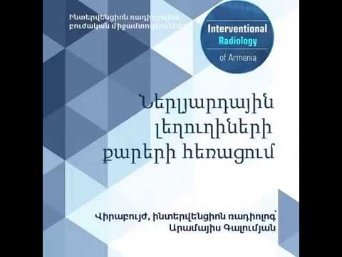 Video: Լեղուղիների քաղցկեղ կատուներում