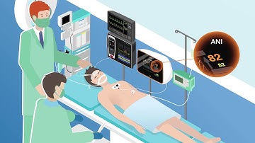 MDoloris Medical Systems presents ANI (Analgesia Nociception Index) technology