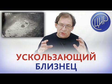 Видео: У меня был исчезающий близнец?