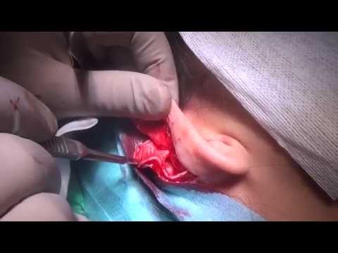 Video: ❶ När Operationen Kan Undvikas