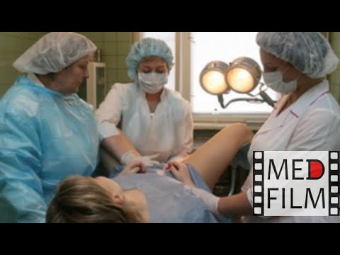 Video: Vaginálny Výtok Z Fretiek