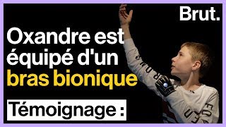 Oxandre est le premier Français équipé d'un bras bionique