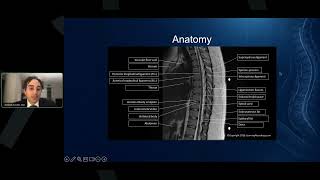 ASPN Young Innovators Present: Beyond the Report: How Pain Physicians Should Read a Spine MRI