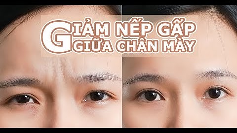 Bài tập đánh bay nếp nhăn giữa chân mày | Kilala | Làm Đẹp Chuẩn Nhật
