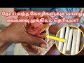 நோய் வந்த கோழிகளுக்கு வாழை எவ்வளவு முக்கியம் தெரியுமா?|Uses of banana stem in tamil