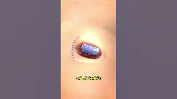 لماذا يضع الأطباء الإصبع المبتور داخل البطن قصص واقعية معلومات صحية حقائق غريبة 