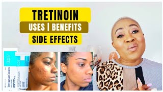 TRETINOIN For Skin Lightening and Acne - Benefits, Side Effects, Use